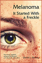 Melanoma: It Started with a Freckle